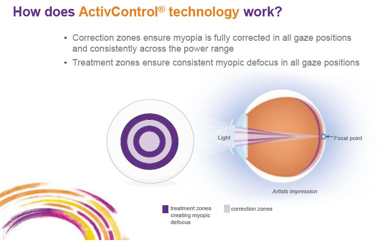 CooperVision Active Control Technologie
