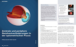 Zentrale und periphere Netzhautveränderungen 