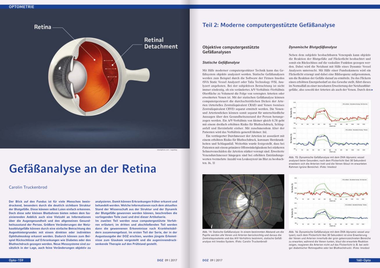 Optometrie Gefäßanalyse Retina