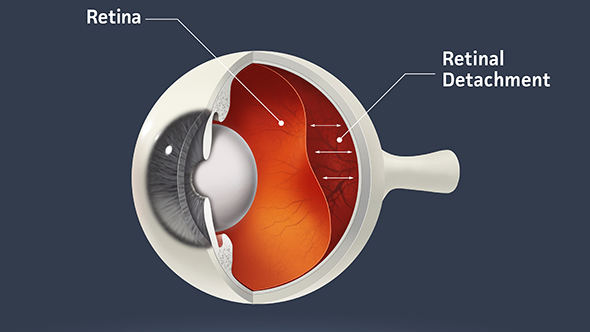 Aufbau Auge mit Blick auf Retina