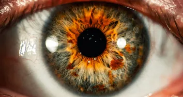 Netzhauterkrankungen