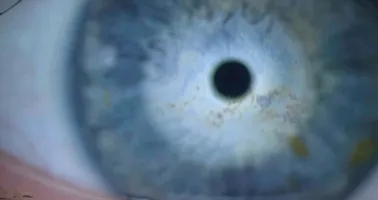 Blick ins Auge
