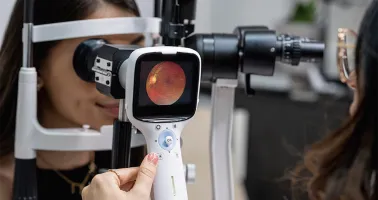 Fundus