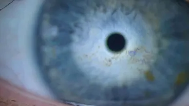 Blick ins Auge