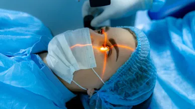 Augenlaser OP