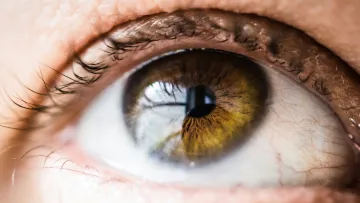 Auge