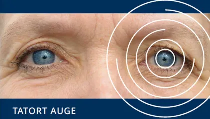 Auge mit Kreisen 
