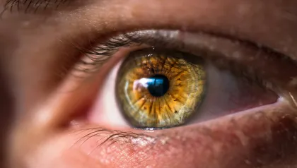 Auge