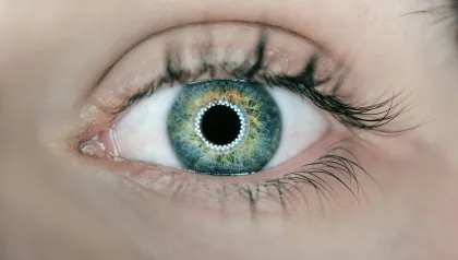 Auge