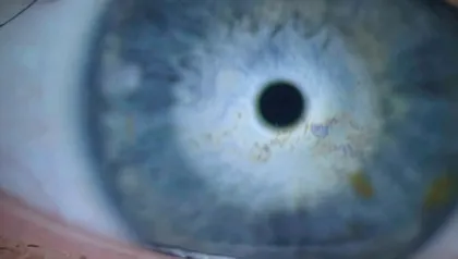 Blick ins Auge