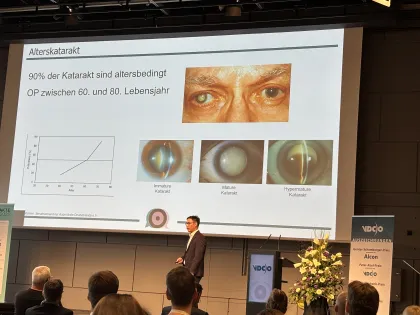 Vortrag über Katarakt-Arten