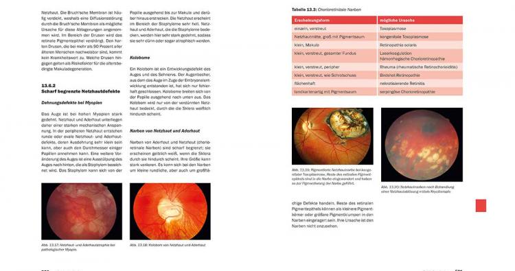 Vorschau in das Fachbuch Optometrisches Screening von Andreas Berke