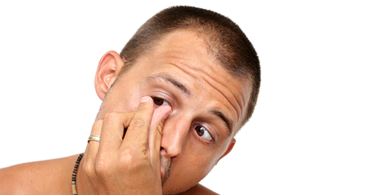 Mann nimmt Kontaktlinse aus dem Auge
