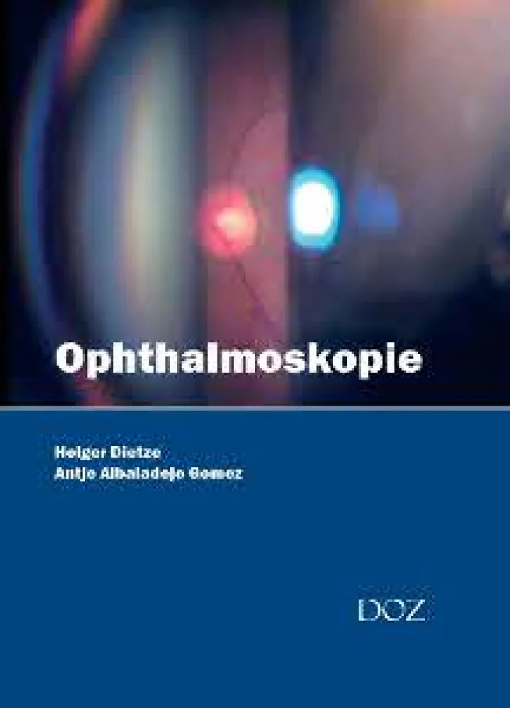 Ophthalmoskopie