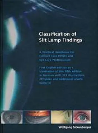 Classification of Slit Lamp Findings
