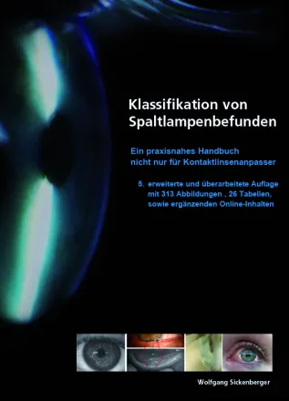 Klassifikation von Spaltlampenbefunden